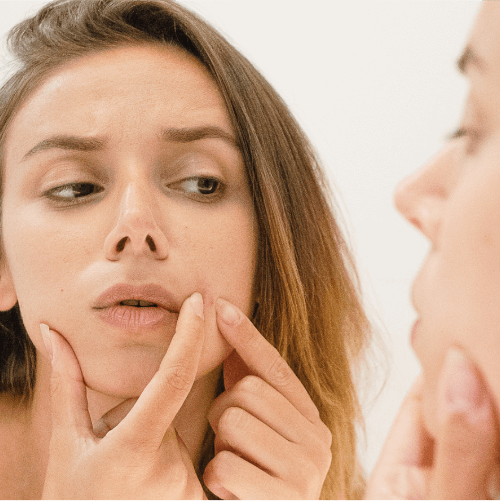 Spot Treatment Gel